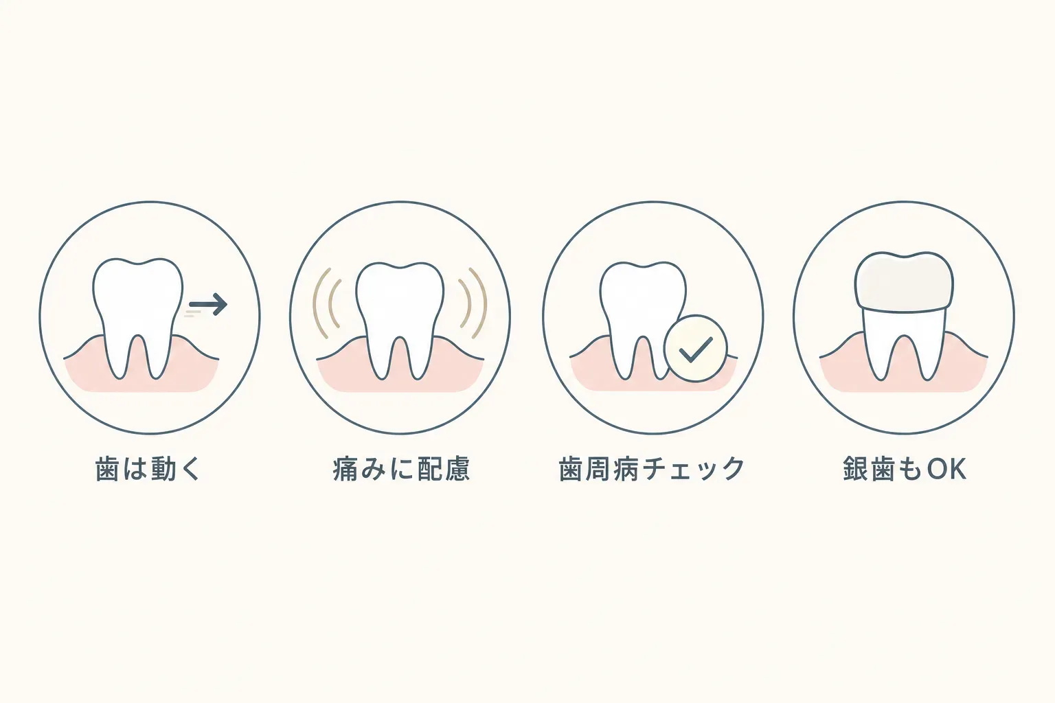 大人の矯正は今さら？「痛い・歯周病・銀歯」の不安に矯正歯科が答えますの解説イラスト