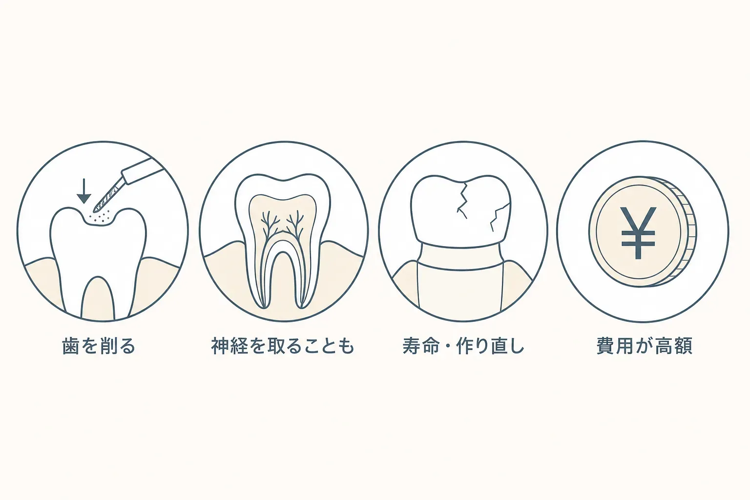 「セラミック矯正」とは？歯を削るリスクと本来の歯列矯正との違いを正直に解説の解説イラスト