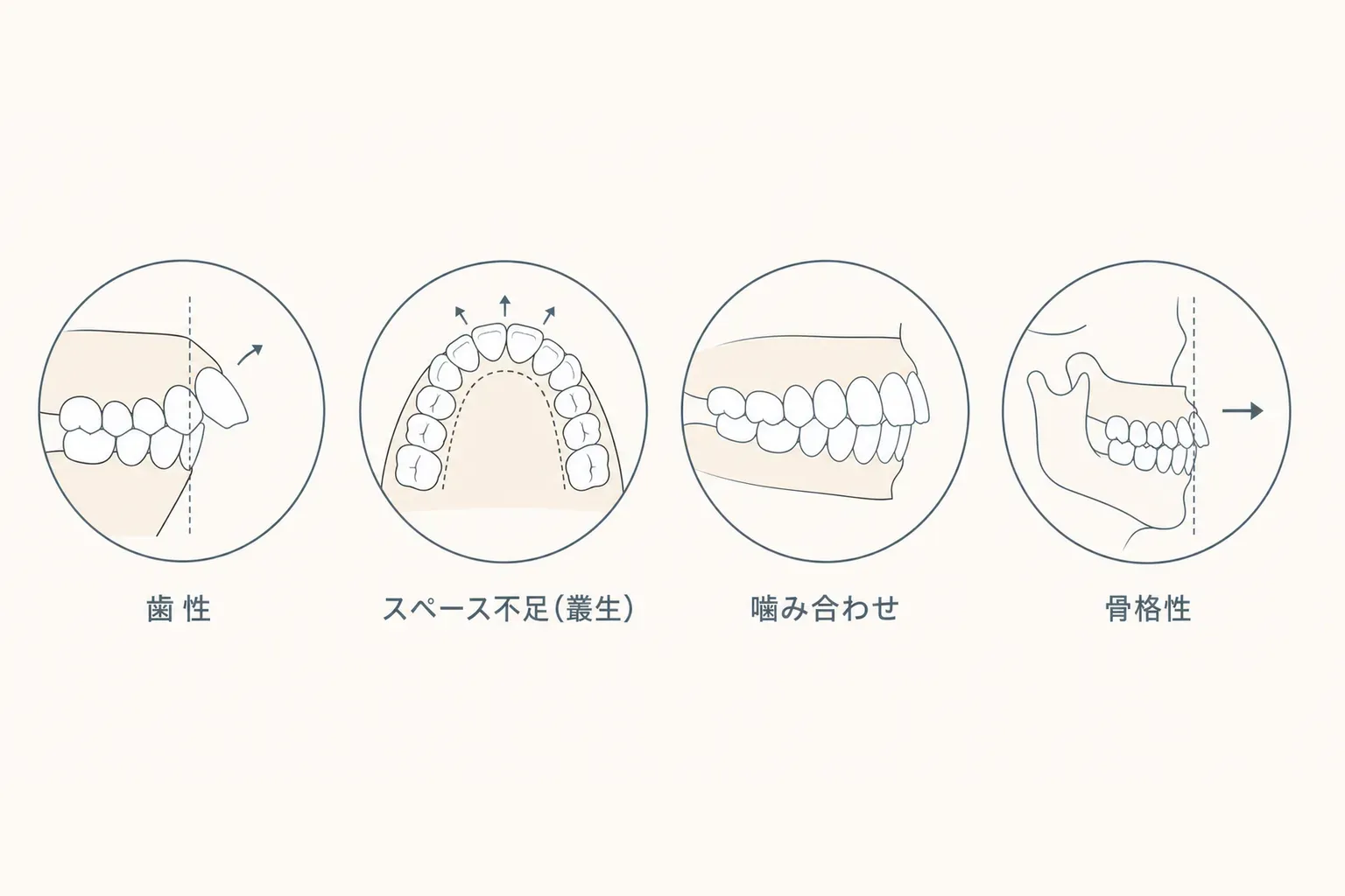 Eライン（横顔）のセルフチェック方法｜矯正で改善できる？日本人の基準値を解説の解説イラスト